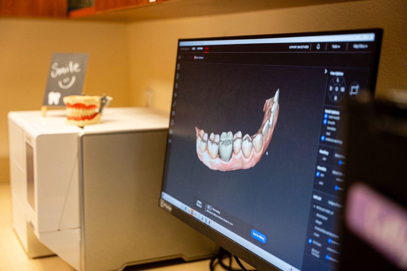 A computer screen showing an image of teeth